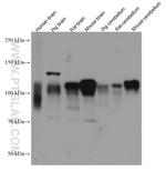 NLGN1 Antibody in Western Blot (WB)