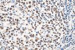 IKZF1 Antibody in Immunohistochemistry (Paraffin) (IHC (P))