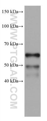 IKZF1 Antibody in Western Blot (WB)