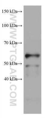 IKZF1 Antibody in Western Blot (WB)