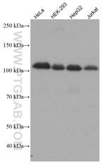 HK2 Antibody in Western Blot (WB)