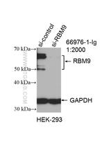 FOX2/RBM9 Antibody in Western Blot (WB)