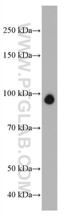 NBN Antibody in Western Blot (WB)