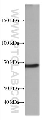 TP73 Antibody in Western Blot (WB)