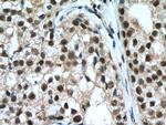 NFKB1 Antibody in Immunohistochemistry (Paraffin) (IHC (P))