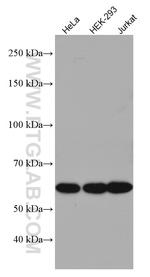 UBAP1 Antibody in Western Blot (WB)