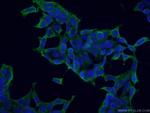 COPE Antibody in Immunocytochemistry (ICC/IF)