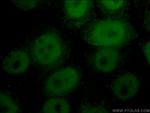 CTBP1 Antibody in Immunocytochemistry (ICC/IF)