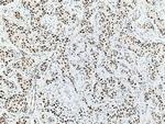 NUP50 Antibody in Immunohistochemistry (Paraffin) (IHC (P))