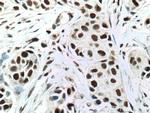 NUP50 Antibody in Immunohistochemistry (Paraffin) (IHC (P))