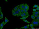 RRM2 Antibody in Immunocytochemistry (ICC/IF)