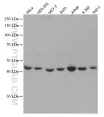 RRM2 Antibody in Western Blot (WB)