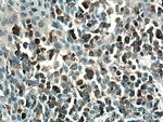 PLCG2 Antibody in Immunohistochemistry (Paraffin) (IHC (P))