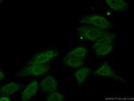 NEIL1 Antibody in Immunocytochemistry (ICC/IF)