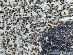 NEIL1 Antibody in Immunohistochemistry (Paraffin) (IHC (P))