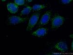 COMMD1 Antibody in Immunocytochemistry (ICC/IF)