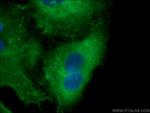 FMO2 Antibody in Immunocytochemistry (ICC/IF)