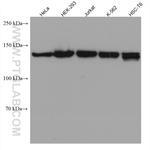 TIMELESS Antibody in Western Blot (WB)