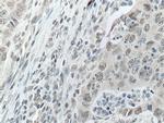 DDX5 Antibody in Immunohistochemistry (Paraffin) (IHC (P))