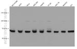 DDX5 Antibody in Western Blot (WB)