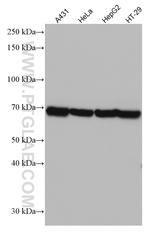 DDX5 Antibody in Western Blot (WB)