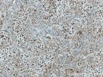 PRC1 Antibody in Immunohistochemistry (Paraffin) (IHC (P))