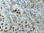 PRC1 Antibody in Immunohistochemistry (Paraffin) (IHC (P))