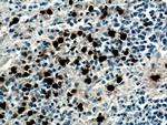 PRTN3 Antibody in Immunohistochemistry (Paraffin) (IHC (P))