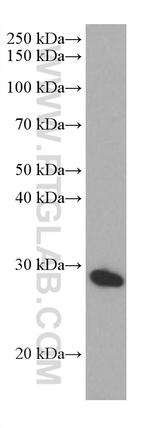 PRTN3 Antibody in Western Blot (WB)