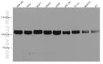 KDM1 Antibody in Western Blot (WB)