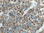 CYP27A1 Antibody in Immunohistochemistry (Paraffin) (IHC (P))