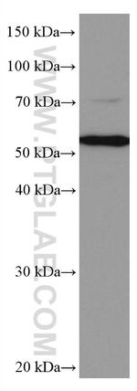 CYP27A1 Antibody in Western Blot (WB)