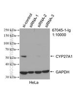 CYP27A1 Antibody in Western Blot (WB)