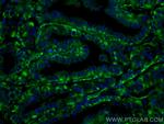 GUK1 Antibody in Immunohistochemistry (Paraffin) (IHC (P))