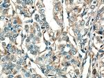 GUK1 Antibody in Immunohistochemistry (Paraffin) (IHC (P))