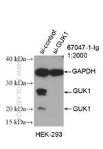 GUK1 Antibody in Western Blot (WB)