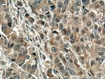 SMAD5 Antibody in Immunohistochemistry (Paraffin) (IHC (P))