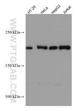 ERCC5 Antibody in Western Blot (WB)