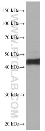 ATX3/ATXN3 Antibody in Western Blot (WB)