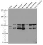 PDE4D Antibody in Western Blot (WB)