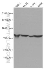 ADRBK1 Antibody in Western Blot (WB)