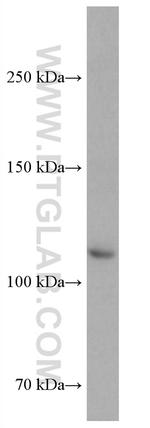 ASK1 Antibody in Western Blot (WB)