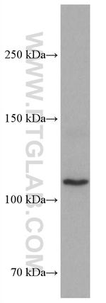 ASK1 Antibody in Western Blot (WB)