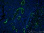 Endoglin/CD105 Antibody in Immunohistochemistry (PFA fixed) (IHC (PFA))