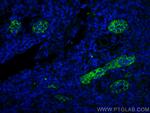 Endoglin/CD105 Antibody in Immunohistochemistry (PFA fixed) (IHC (PFA))