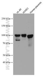 Endoglin/CD105 Antibody in Western Blot (WB)