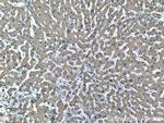 CES1 Antibody in Immunohistochemistry (Paraffin) (IHC (P))