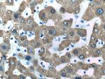 CES1 Antibody in Immunohistochemistry (Paraffin) (IHC (P))