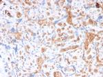 Spectrin Alpha 1 (Erythrocyte Marker) Antibody in Immunohistochemistry (Paraffin) (IHC (P))