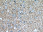 EAAT2 Antibody in Immunohistochemistry (Paraffin) (IHC (P))